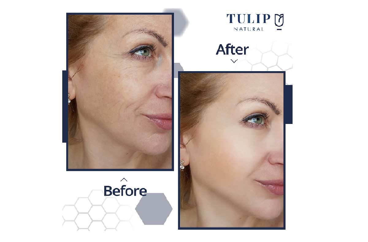 ��� ����� ����������